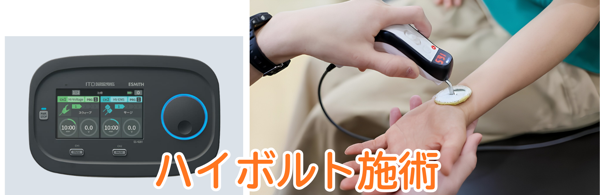 高電圧で痛みの深部にアプローチするハイボルテージ治療器